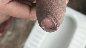 Penis peyronies and phimosis: an overview